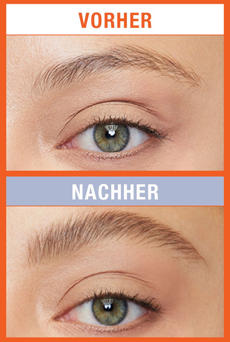 beforeandafter productinfo PDP Oben