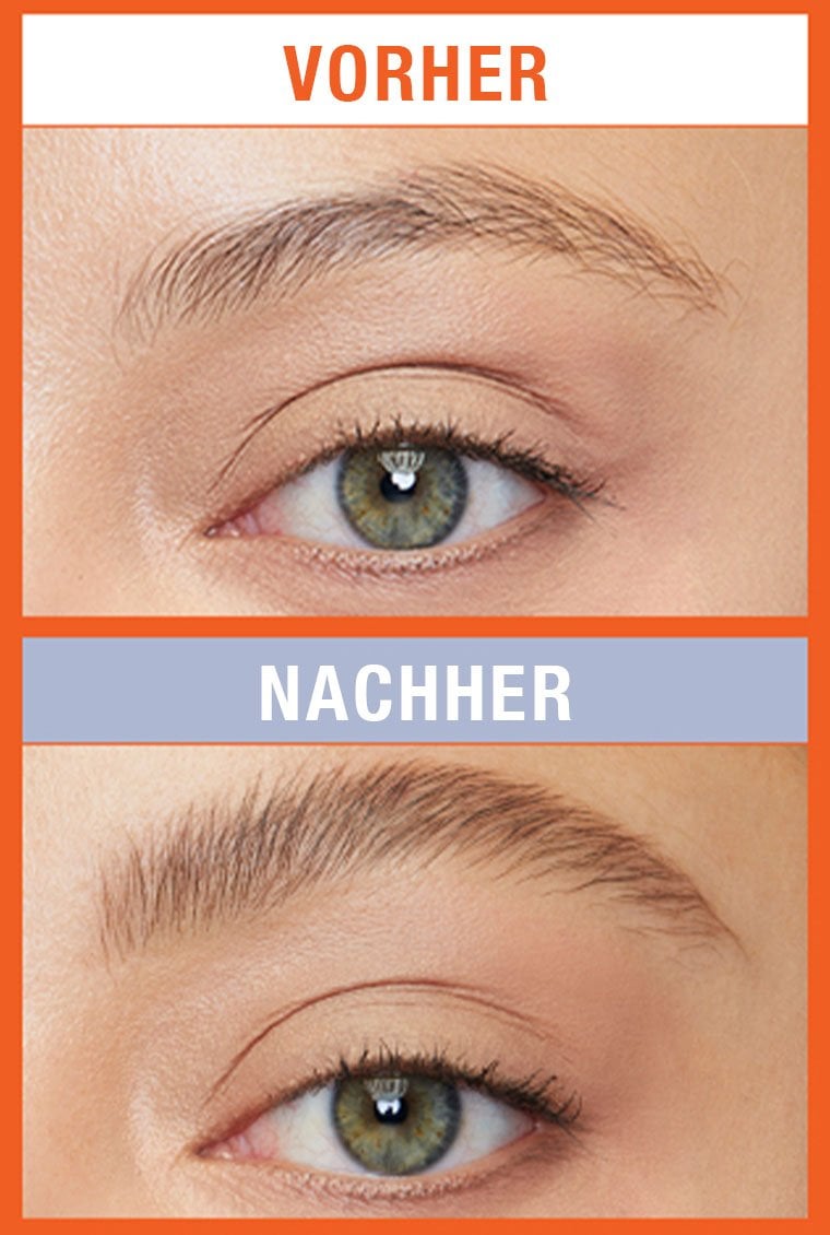 beforeandafter productinfo PDP Oben