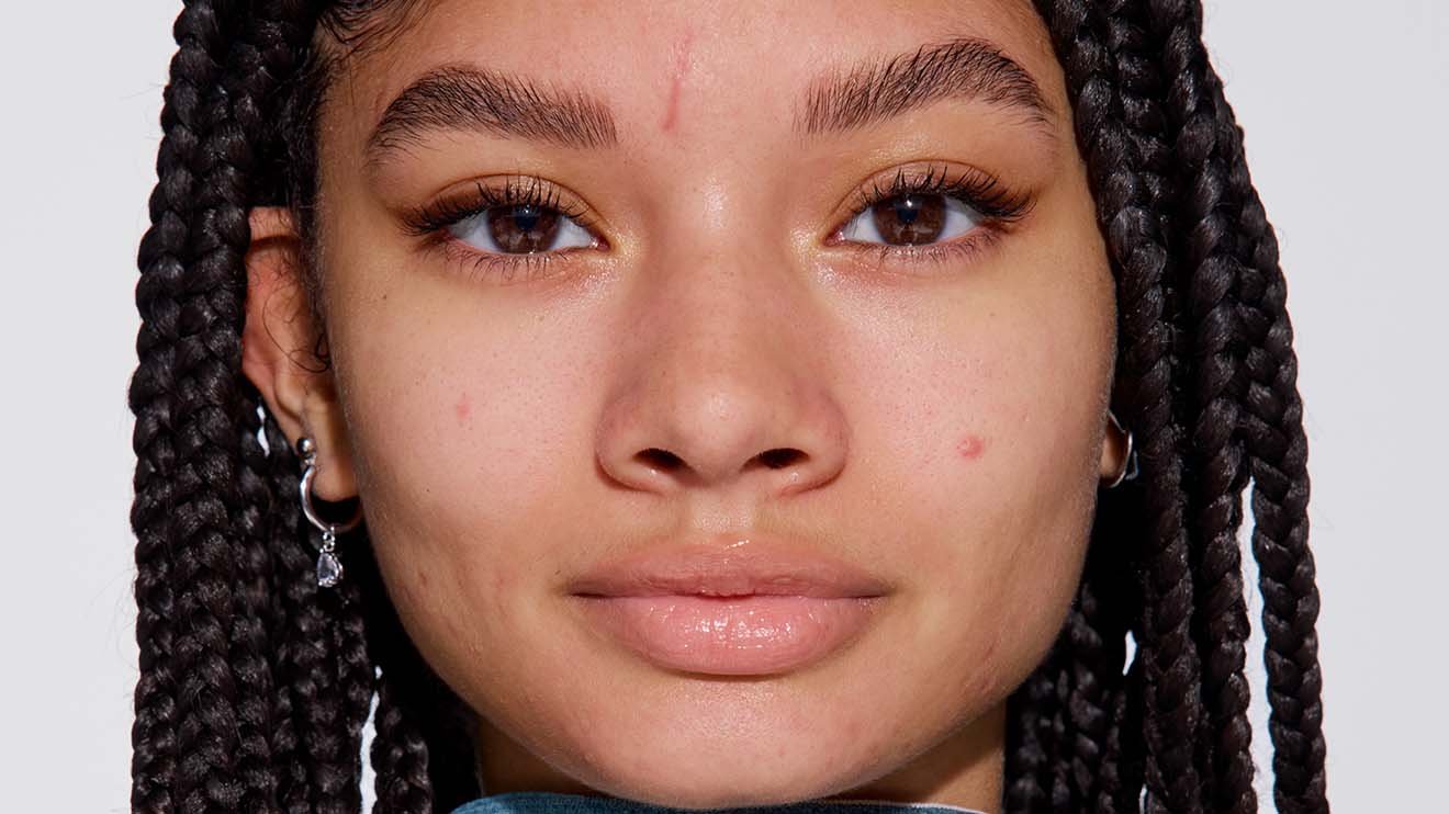 20260521 Maybelline Fit Me Microscopic concealer model before