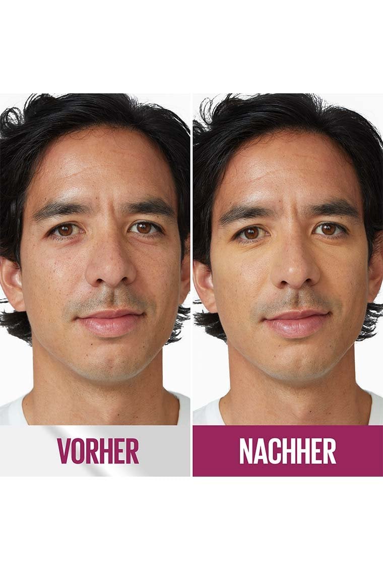 vorher nachher
